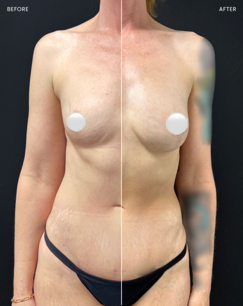 Image may contain Body Part Person Torso Medication Pill and Adult